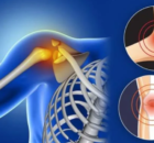 Vitamin D deficiency can cause serious diseases