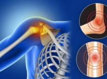 Vitamin D deficiency can cause serious diseases